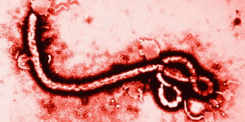 تحقیق جدید درباره بیماری ابولا | مقاله مخصوص ویروس ابولا