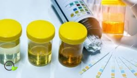 خطر دفع پروتئین در ادرار یک زن باردار