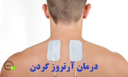 روش کنترل ودرمان آرترز گردن