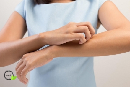 چجوری خارش بدن رو درمان کنیم